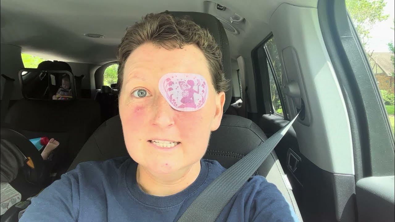 Can You Drive With One Eye